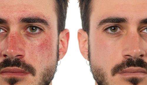 Wirkstoffkosmetik für Herren