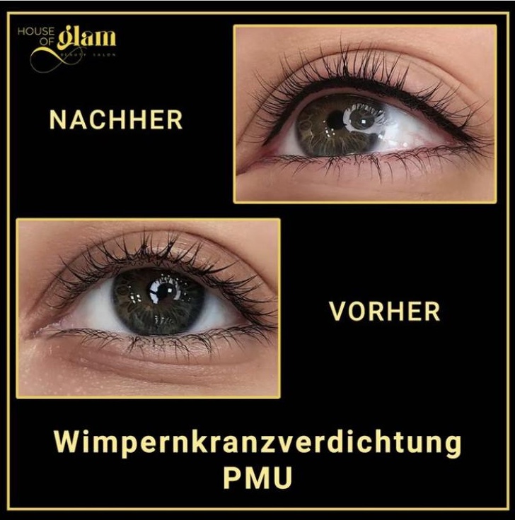 PMU Wimpernkranzverdichtung