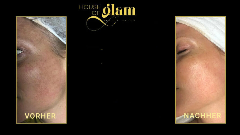 House-of-Glam-BBglow (1)